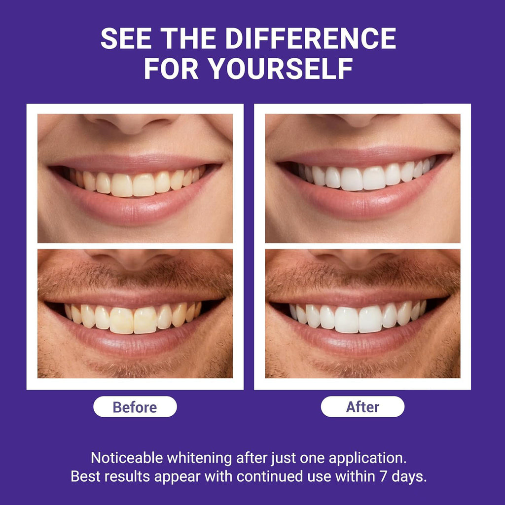 Luniora  nHAP-Pro Whitening Strips
