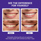 Luniora  nHAP-Pro Whitening Strips